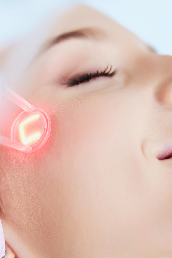 Nira Precision Laser I Tried It For 90 Days on My Hooded Eyes